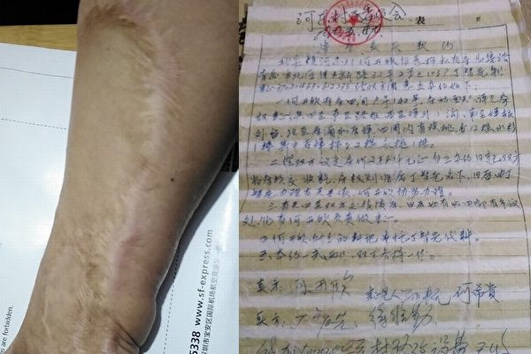 山东崂山政府逼拆民宅 工伤致残女孟环玲恐露宿街头