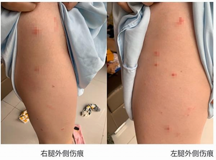 d62a6059252dd42a56f2d19c745e23b3c8eab8fe.jpeg d62a6059252dd42a56f2d19c745e23b3c8eab8fe.jpeg