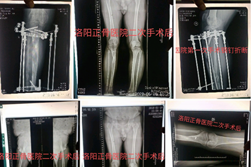 536de83a45af21b16b467-600x400.png 536de83a45af21b16b467-600x400.png