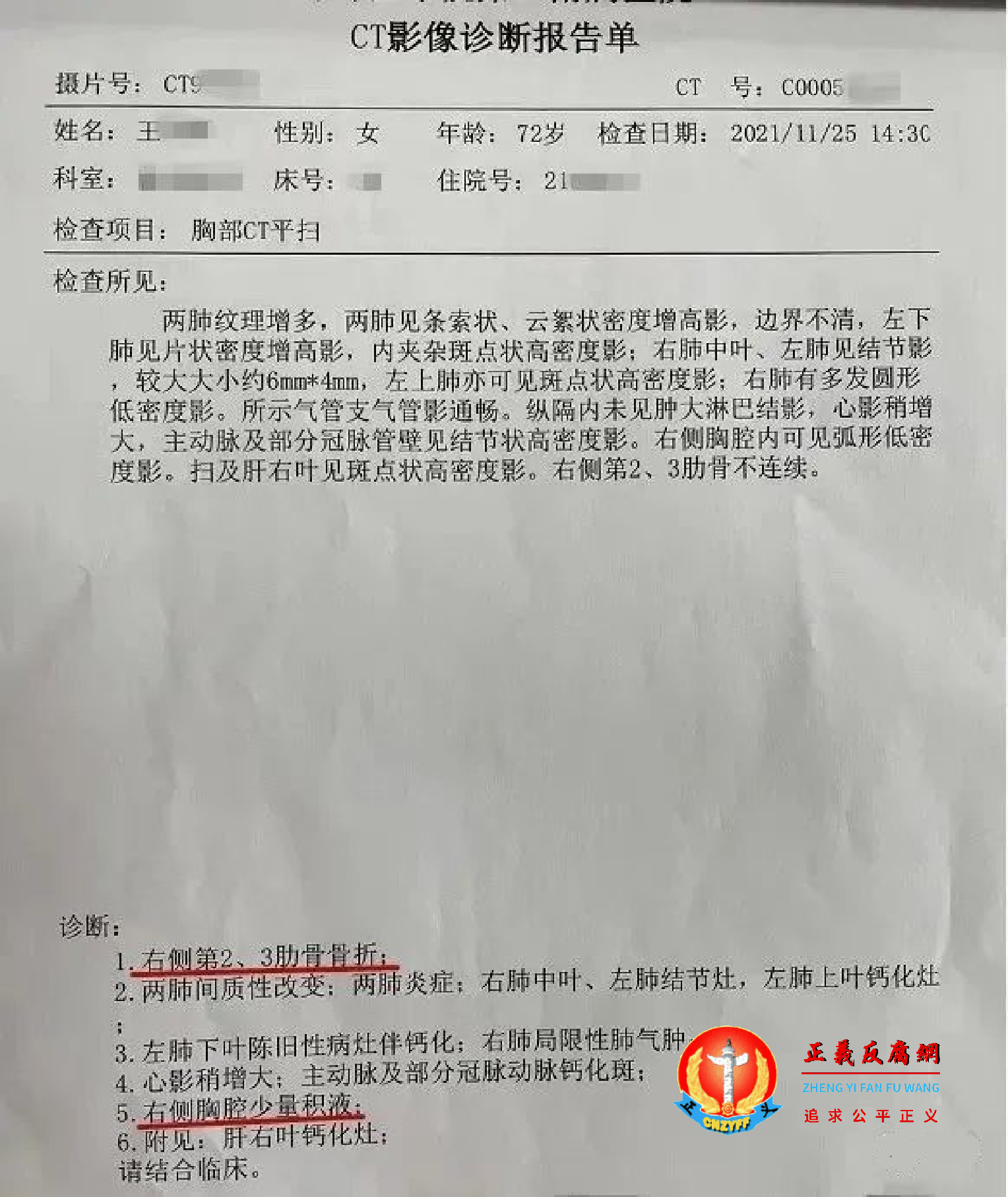 蚌埠医学院第二附属医院的一份CT影像诊断报告单.png