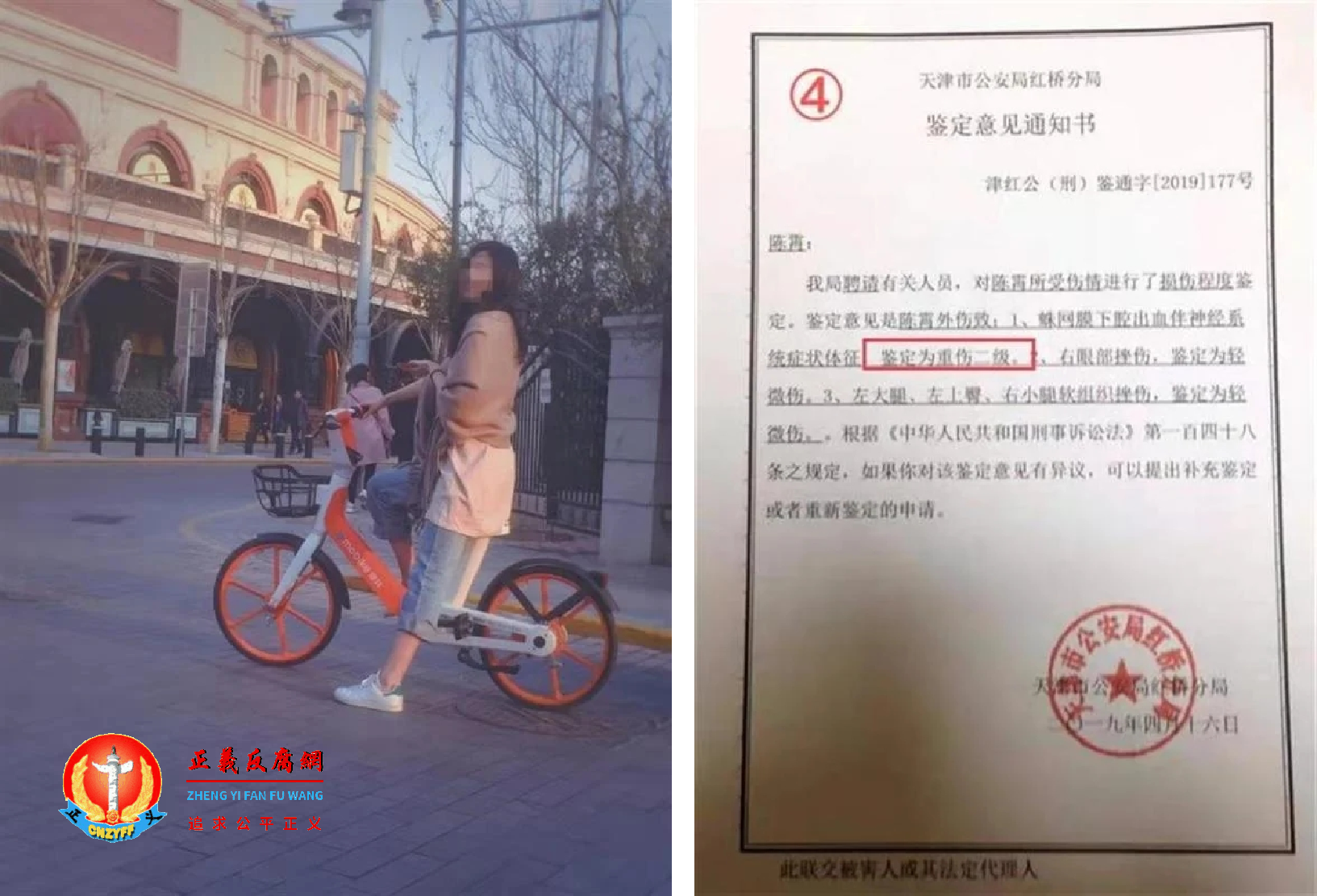 陈婷生前照片(左)以及她受伤后的医院鉴定(右)。.png 陈婷生前照片(左)以及她受伤后的医院鉴定(右)。.png