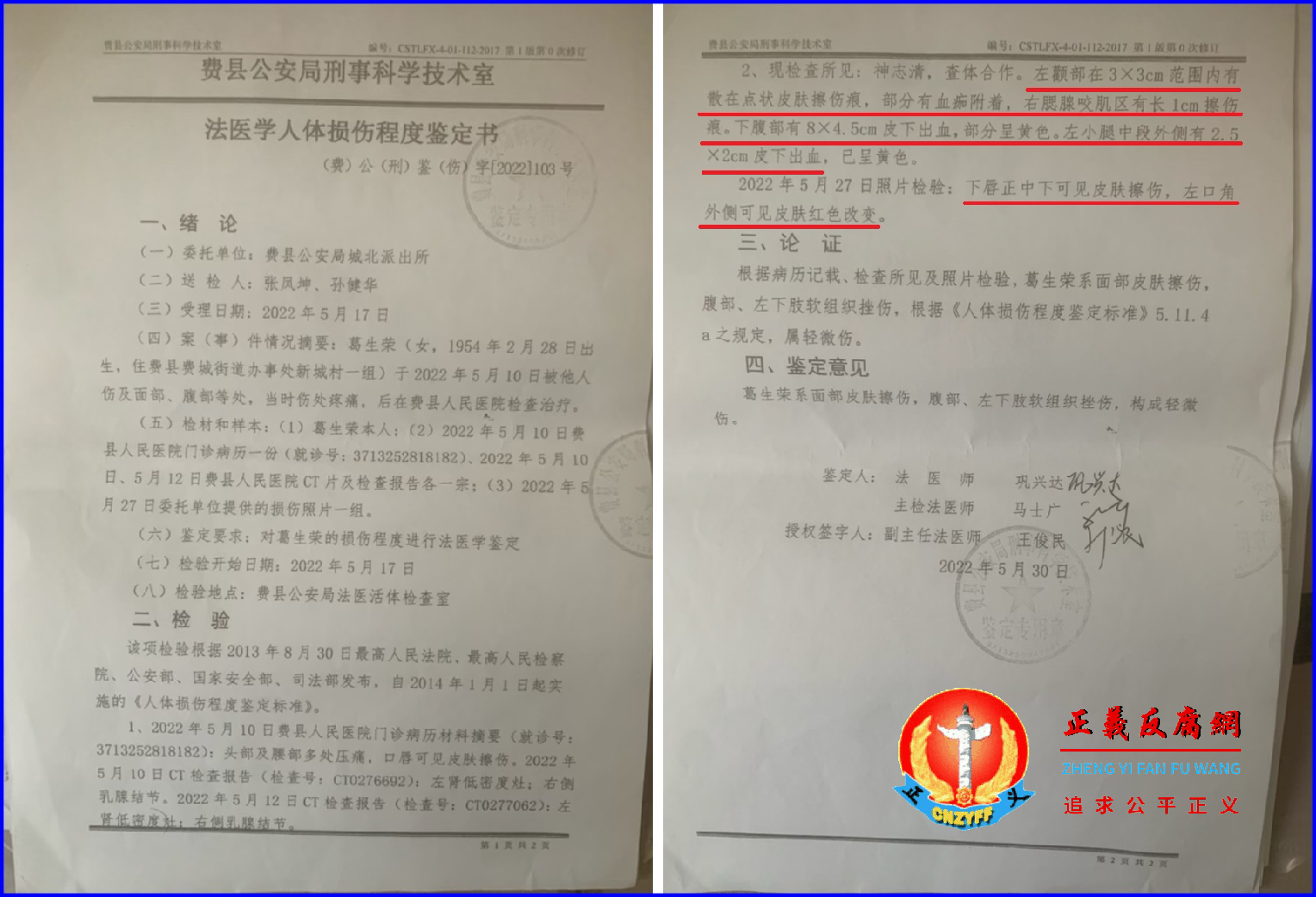 2022年5月30日,费县公安局刑事科学技术室(法医学人体损伤程度签定书),(费)公(刑)鉴(伤)字〔2022〕103号,葛生荣鉴定为轻微伤。.png 2022年5月30日,费县公安局刑事科学技术室(法医学人体损伤程度签定书),(费)公(刑)鉴(伤)字〔2022〕103号,葛生荣鉴定为轻微伤。.png
