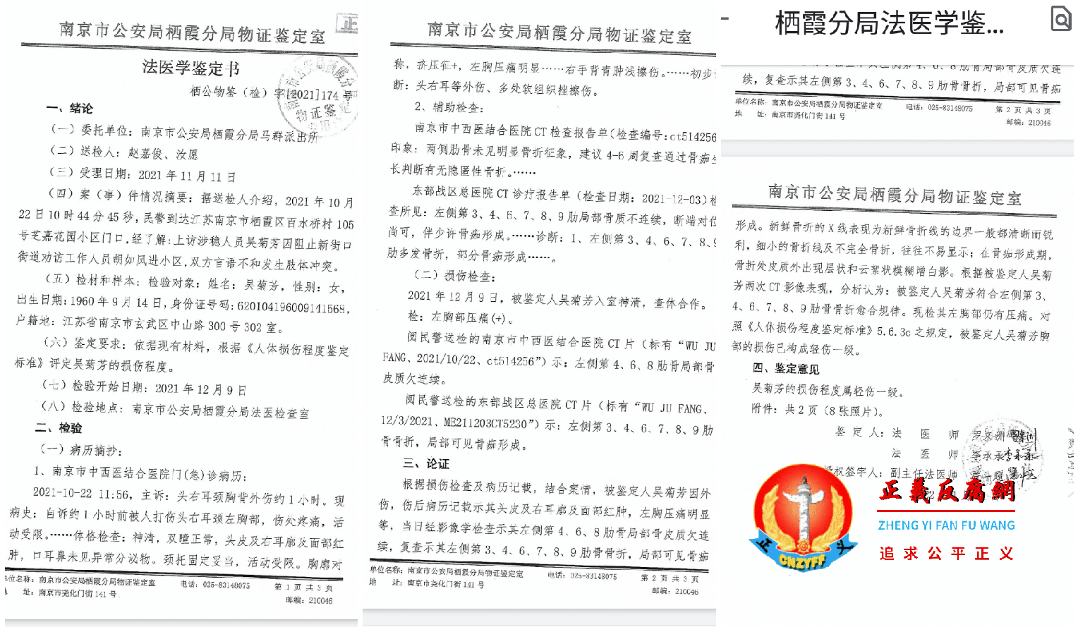 访民吴菊芳肋骨被打断六根,南京市公安局栖霞分局法医学鉴定书,栖公物鉴(检)字〔2021〕174号作出了轻伤一级法医鉴定书。.png 访民吴菊芳肋骨被打断六根,南京市公安局栖霞分局法医学鉴定书,栖公物鉴(检)字〔2021〕174号作出了轻伤一级法医鉴定书。.png