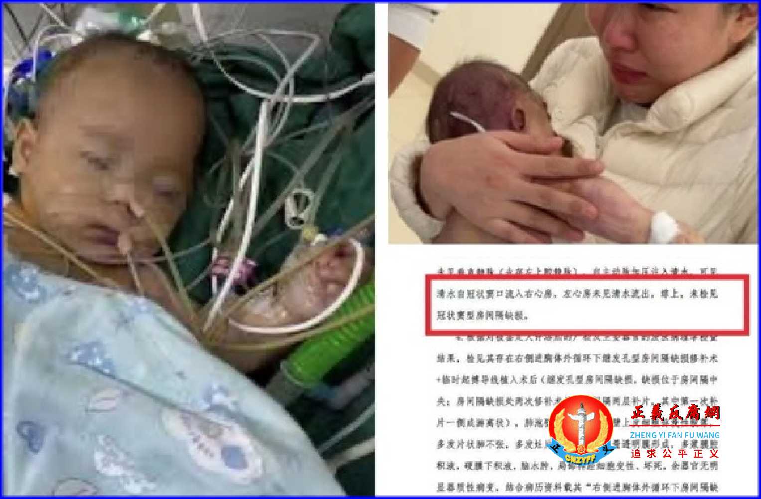 浙江宁波女婴小洛熙尸检报告出炉，手术存在重大失误，院方删除发布情况说明